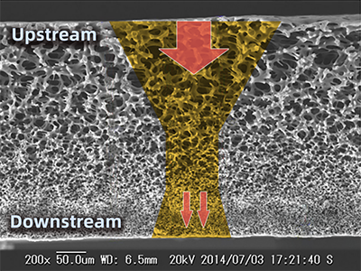 Plasma Separation by PSM Series Red Blood Cell Filter -BCT.png